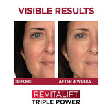 Revitalift Triple Power Anti-Aging Face Moisturizer