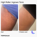 High Roller Ingrown Hair Tonic with AHA and BHA