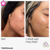 Faded Serum for Dark Spots & Discoloration